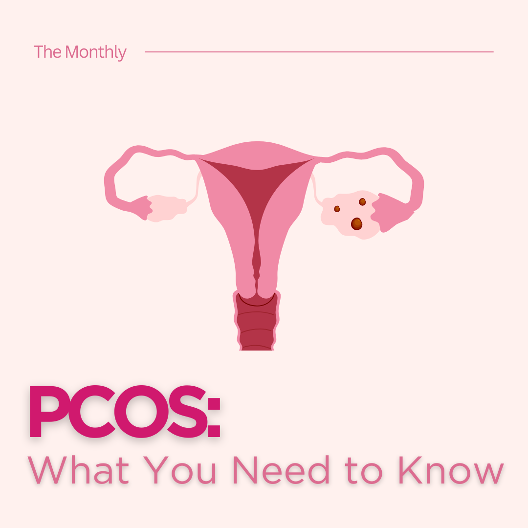 PCOS: What You Need To Know